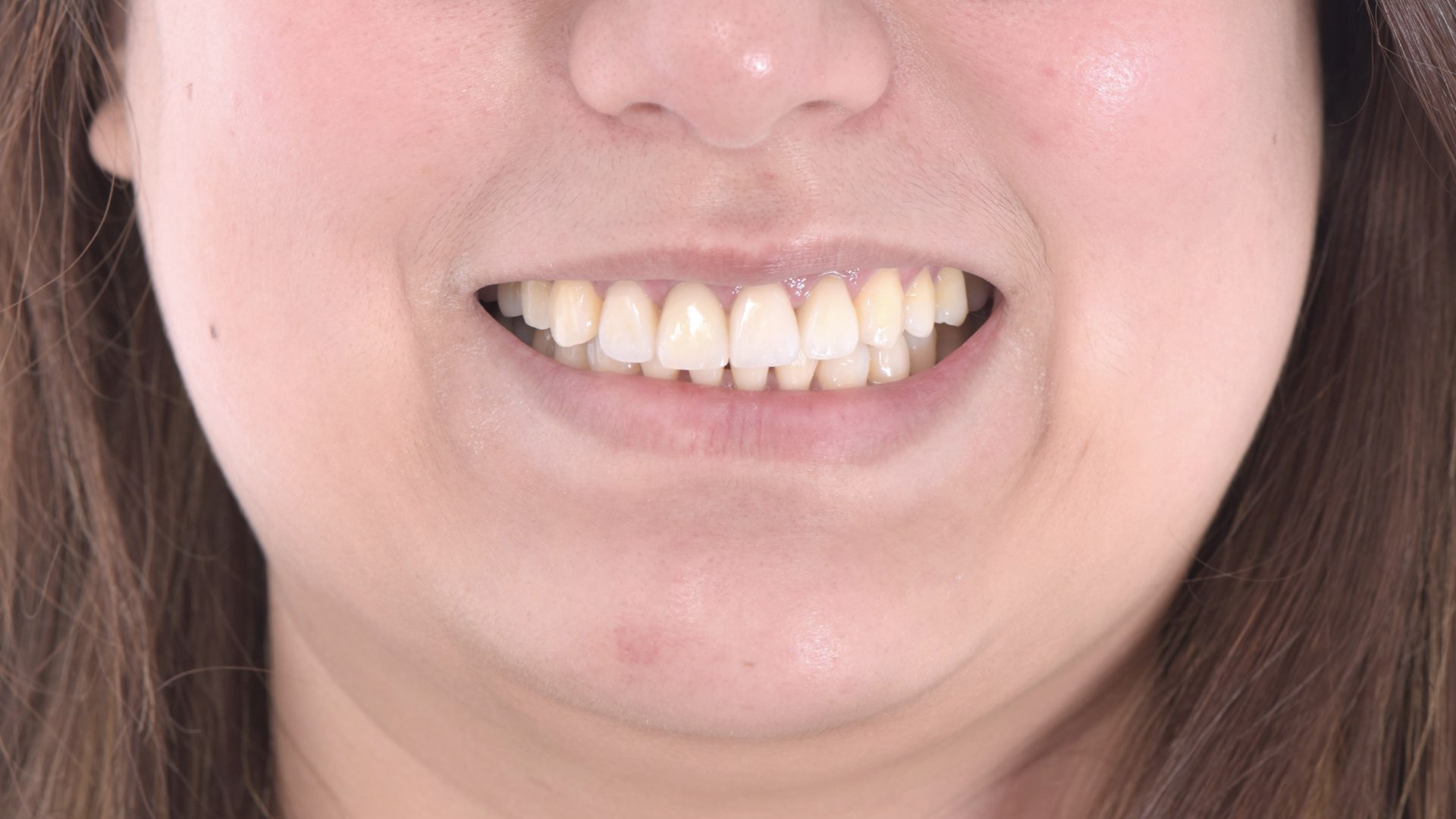 和諧一致的牙齒