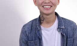 牙齦萎縮變色，牙齒太長----牙齦調整、全口美白、全瓷冠治療