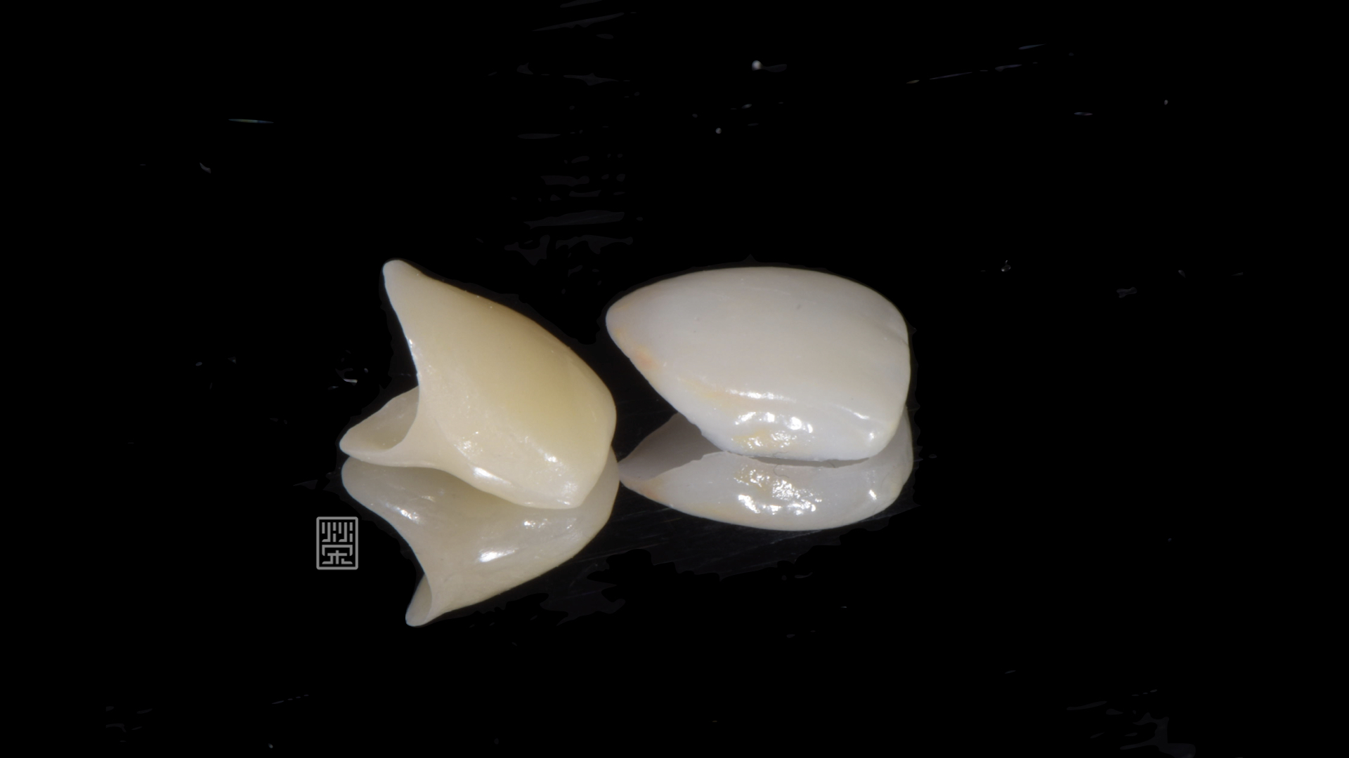 雙層貼片全瓷冠