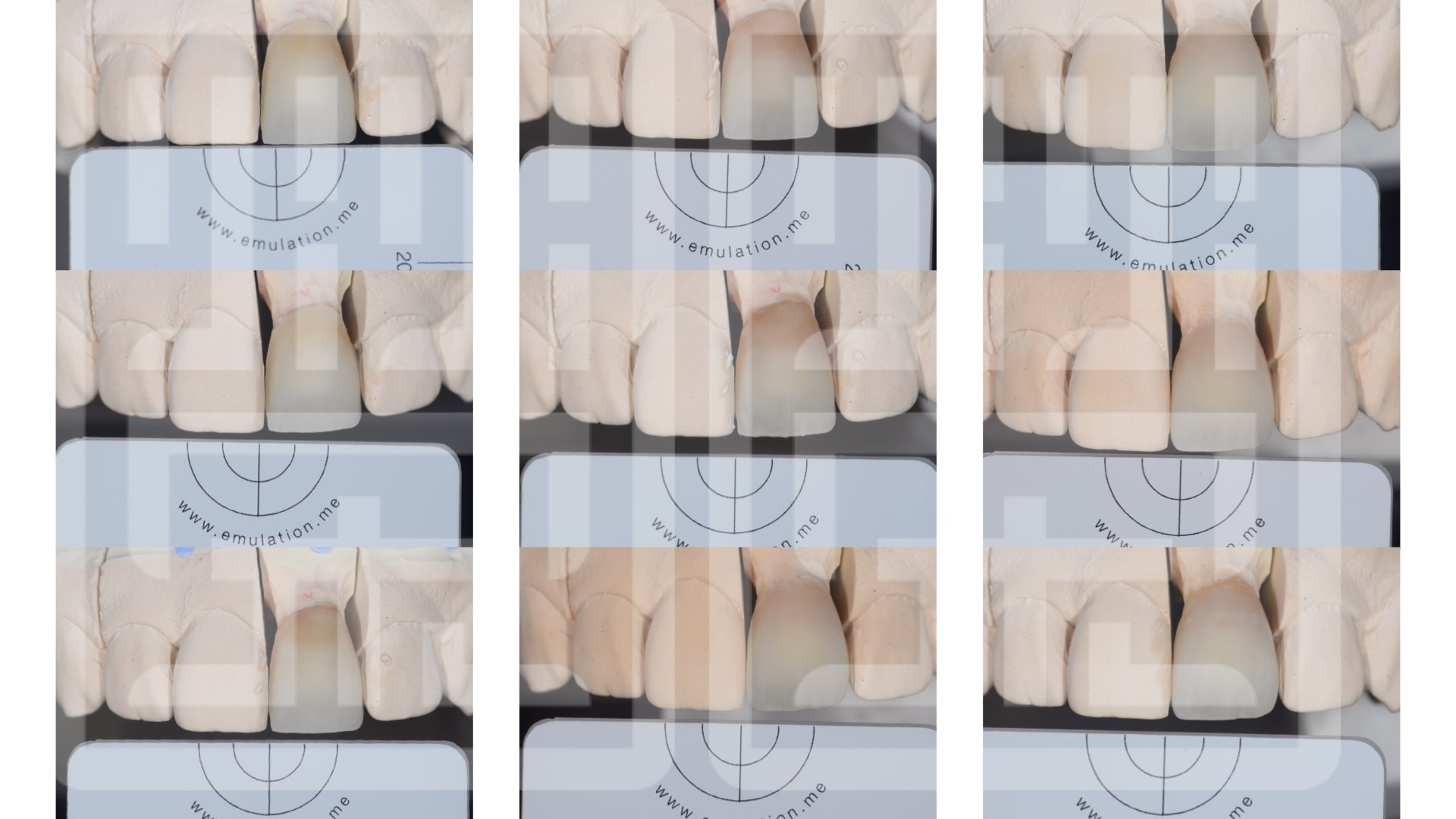 數位驗證比色，模仿對稱牙型態顏色
