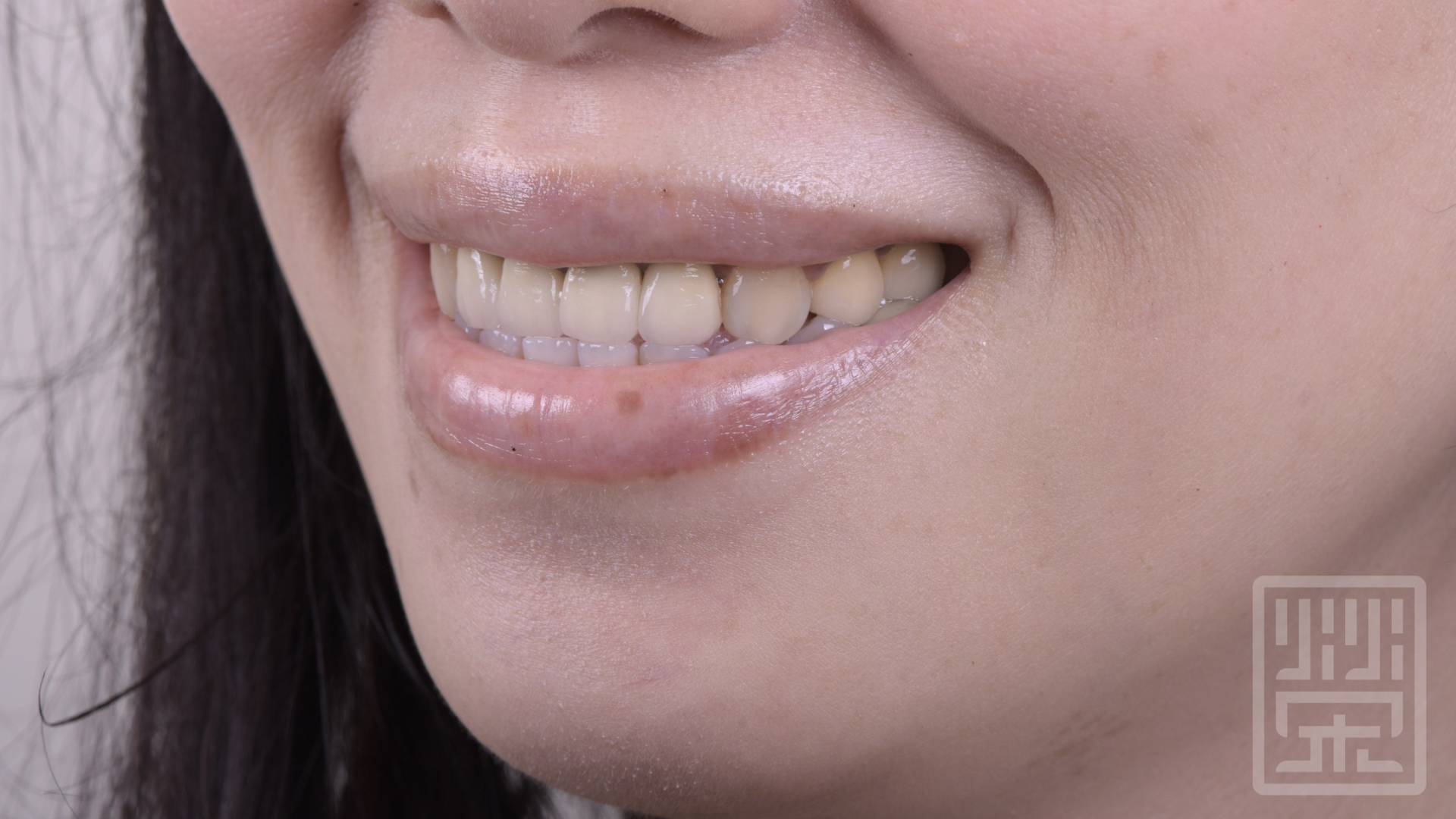 牙齒笑起來平平的，顏色黃