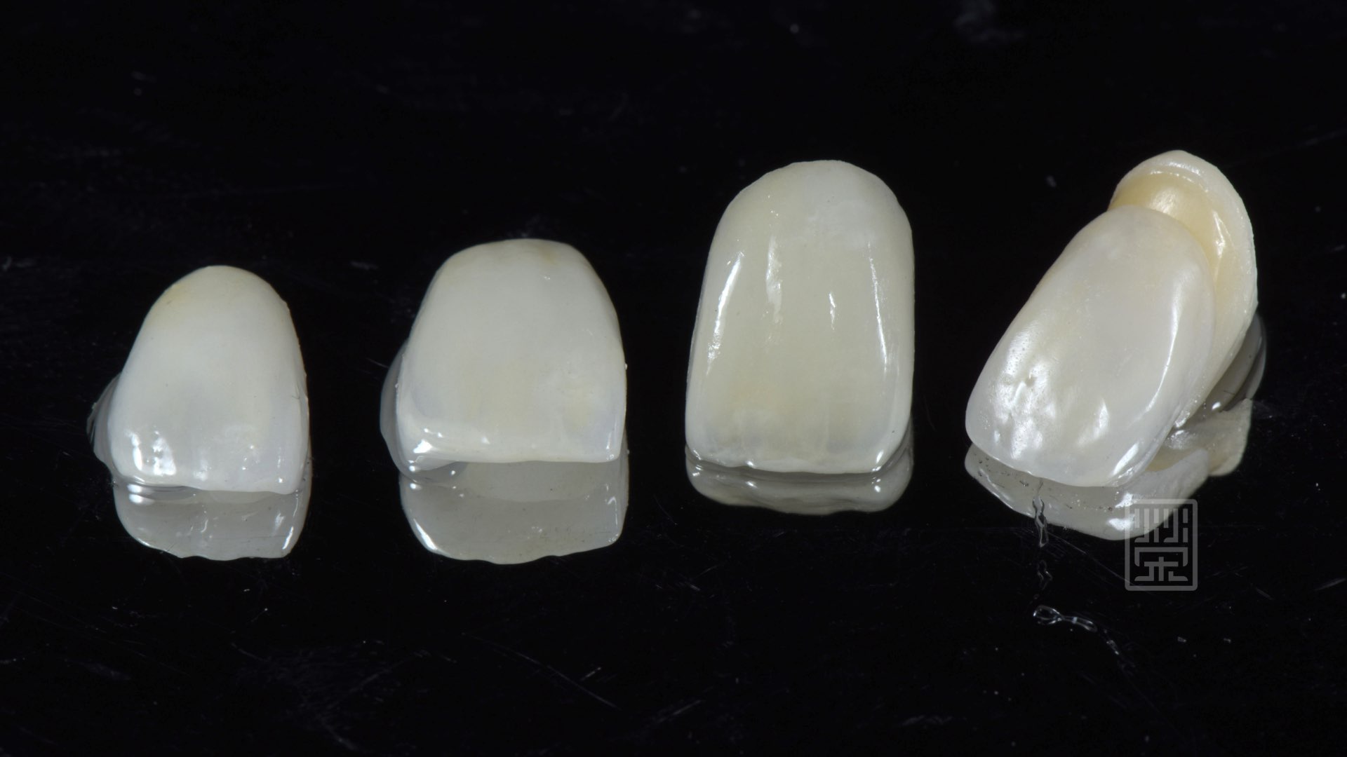 貼片、全瓷冠、全瓷雙層冠